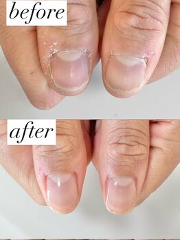 ニコワイズネイル(Nico Y's Nail)/【自爪育成コース】