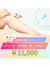『脱毛』初回限定★［レディース］全身美肌脱毛（顔・VIOなし）＋全身保湿