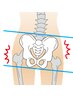 【骨盤のねじれ、ゆがみからくる腰痛改善】姿勢改善オイルケア90分