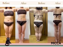 ヨサパーク ミッカ 学芸大学(YOSA PARK MiCCA.)/全身痩せ驚愕の結果　パート２