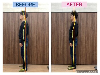 エクティブ整体院/30代男性/ビフォーアフター