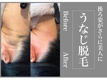 さくら通りクリニック/後ろ姿がさらに美人に！