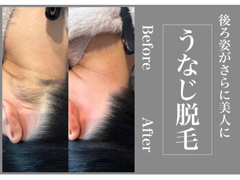 さくら通りクリニック/後ろ姿がさらに美人に!