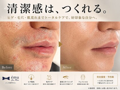 エミュ(emu formen)の写真