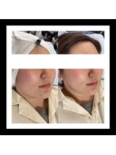 リバイバル(Re:vival)/ブライダルエステとしてもOK