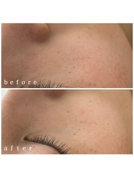 メナードフェイシャルサロン 岐阜茜部/パックホワイトオプション