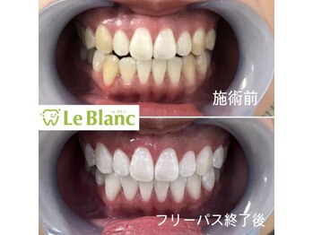 ルブラン 奈良店(Le Blanc)/歯の健康と白さは大切です!