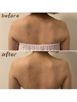 ルアナ 北谷店/リンパマッサージ 《沖縄/北谷》