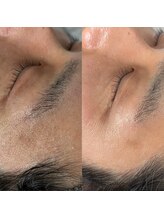 ルブール(levure)/男性にも人気