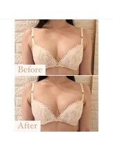 ハニー(Honey)/before★after