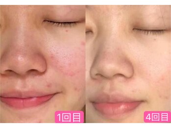 ナチュラ ソース(NatureSouce)/