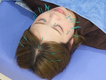 赤沼鍼灸整骨院/しわ改善・むくみ改善したい方◎