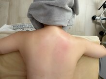 アイスパ 代官山(i-SPA)/右が施術後、張った肩がスッキリ