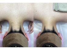 エステティック レイビス 池袋店(RAYVIS)/ブライダル