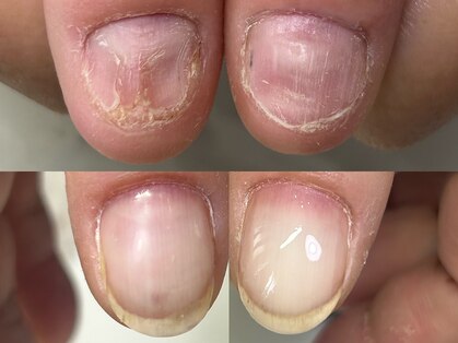 ハッチネイル(HACCI nail)の写真