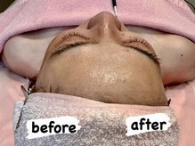 レイ(Rei)の雰囲気(小顔フェイシャル施術で脇、デコルテ、首ケアで首コリ解消!)