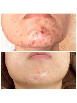 ビューティーホリック 蘇我店(BEAUTY HOLIC)/