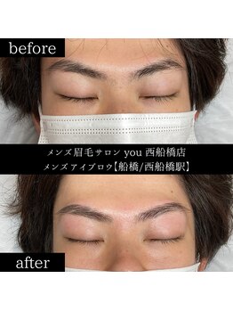 ユー 西船橋店(you)/ビフォーアフター写真