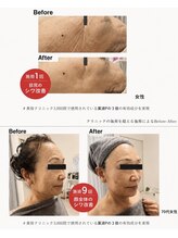 賢者のボディケア/シワ改善ケア☆