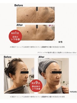賢者のボディケア/シワ改善ケア☆