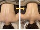 サクラプラス(SAKURA Plus)の写真/首・肩のコリでお悩みの方必見！大人気◇カッピング×リンパマッサージで辛いコリにしっかりアプローチ◎