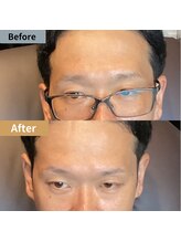 眉毛ハウス 吉祥寺店(眉毛HOUSE)/お客様の施術例(吉祥寺/東京)