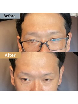 眉毛ハウス 吉祥寺店(眉毛HOUSE)/お客様の施術例(吉祥寺/東京)