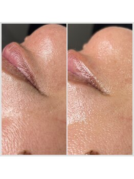 アドリー ラパン(ADRY./ Lapin)/フェイシャルワックス