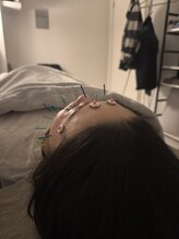 ラフテル鍼灸整骨院/西長堀駅近で美容鍼を！