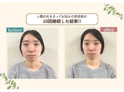 小顔整体研究所 KSラボ 梅田店の写真