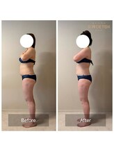 女神デトックス 西宮店(女神DETOX)/ビフォーアフター