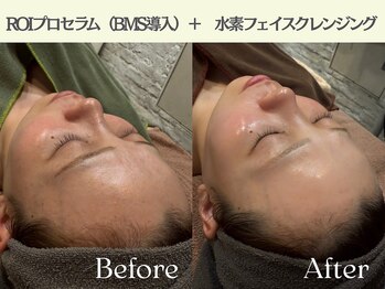 ロイボーテ(ROI Beaute)/くすみオフ×水光ツヤ肌ケア