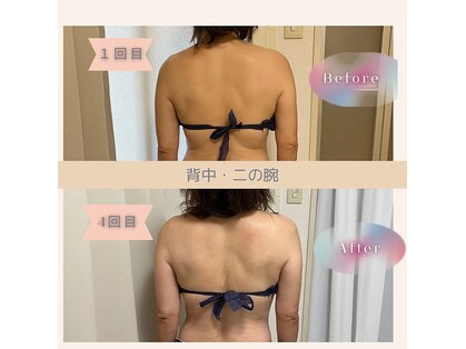 カラン(Calin)の写真