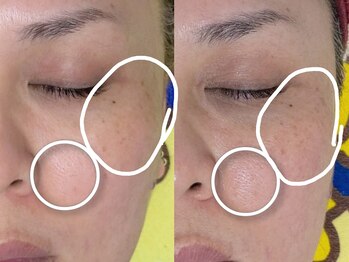 アイラッシュ クレセント(eyelash CRESCENT)/炭酸ムースパック!(店販商品)