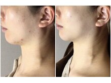 クレビア(CREBIA)/