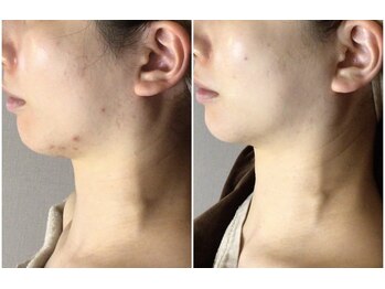 クレビア(CREBIA)/