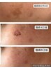 【最新光フォト】がこの価格！！初回♪￥13,000