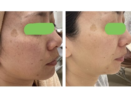 オリーブ(Olive)の写真