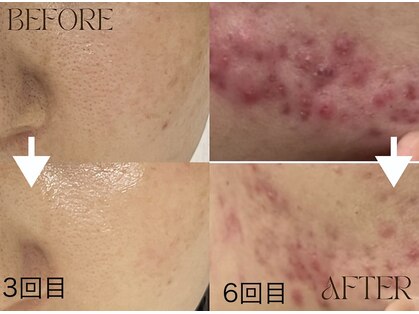 スキニティ(Skinity)の写真