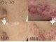 スキニティ(Skinity)の写真