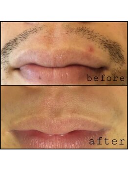 シルクスタンダード(SILK STANDARD)/メンズの髭は専用プログラムで!