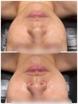 ディア 金町店(Dear)/機械で肩こりケアも♪