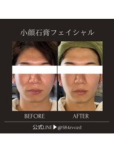 フィールグルック(Viel Gluck)/メンズのお客様にも人気！