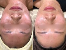 チオリ(Chio-RE)の雰囲気(【カウンセリング無料】好印象な肌育成はChio-REお任せください)