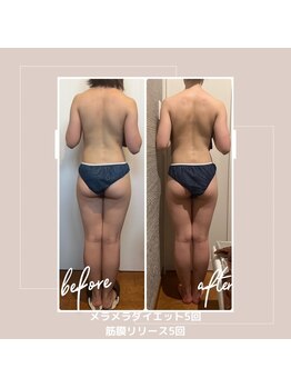 バンブー B2 新涯店(Bamboo)/ブライダル