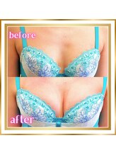 ジュエルリング(Jewel Ring)/バストアップ【恵比寿代官山】