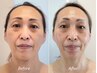 【顔の左右差/歪みのお悩みに】美骨形成術×美容整体で黄金比小顔へ