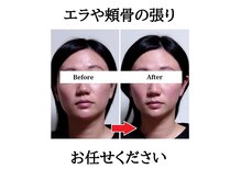 みなと/顔の横幅やエラ張りにも◎