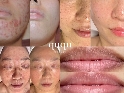 クク(ququ)の写真
