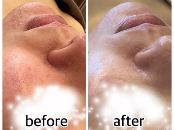インプルーブ エステティック(Improve ESTHETIC)/〈月1ケアで肌荒れしらず〉